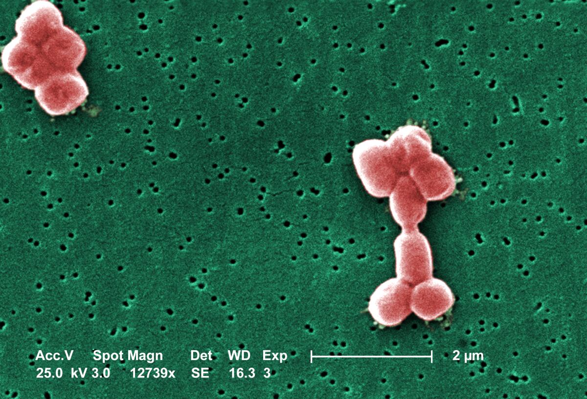 Two clusters of bacteria are shown in a colorized image from a scanning electron microscopic.