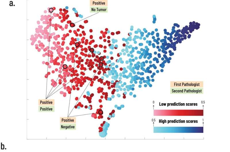 With the number of pathologists declining, team develops AI to be used as a diagnostic tool 