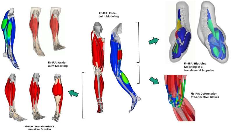 Tailor-made implants for patients thanks to simulations using virtual human modeling