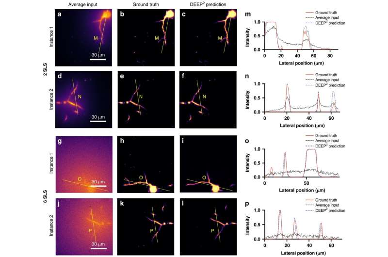 Machine learning techniques give scientists faster returns of high-quality organ images