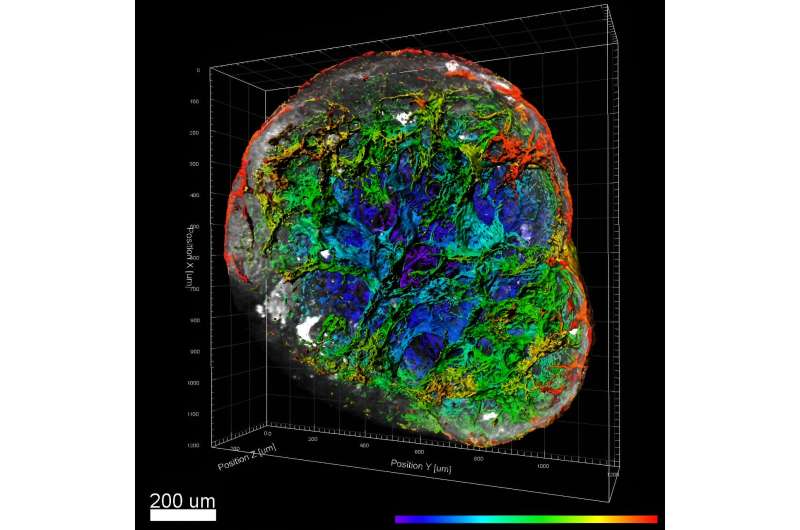 Human vascular organoids reveal clues for a potential COVID treatment