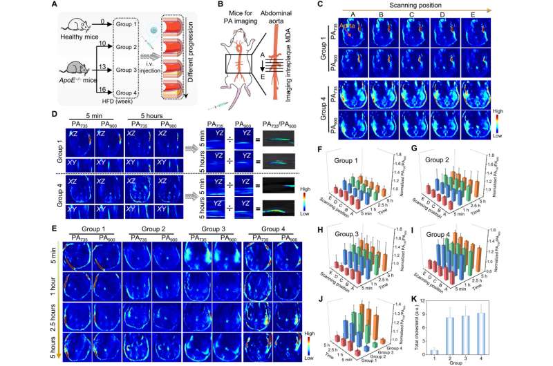 Oxidative stress biomarker triggered multiplexed instrument to diagnose atherosclerosis