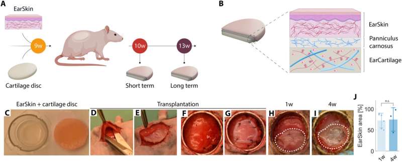 EarSkin and EarCartilage - combining bioengineered human skin with bioprinted cartilage for ear reconstruction