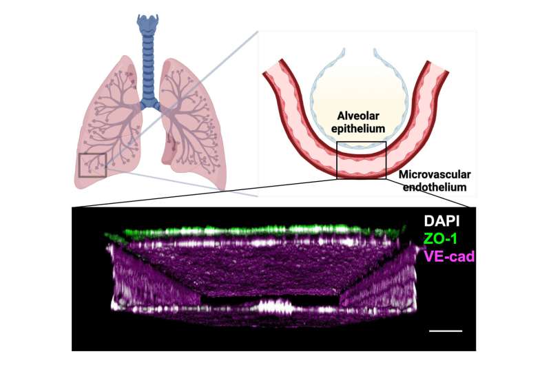 Human Lung Chip leveraged to faithfully model radiation-induced lung injury