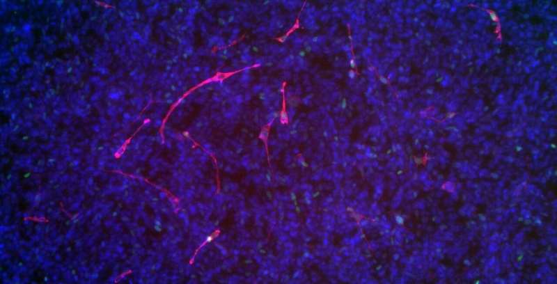 Driving rhabdomyosarcoma into differentiation