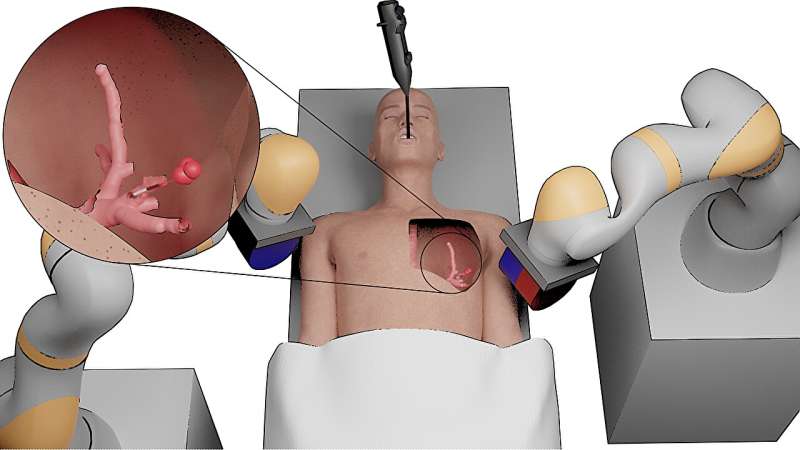 Tiny surgical robots could transform detection and treatment of cancers