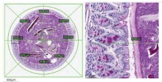 Microbiome: Scientists highlight role of harmful gut bacteria in fever afflicting cancer patients