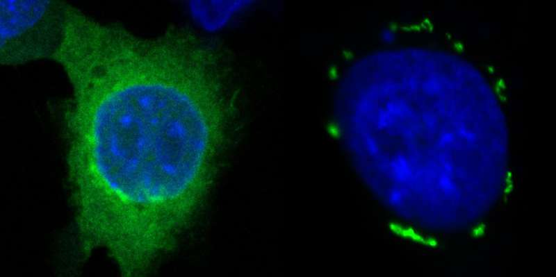 Team introduces new approach in cancer therapy with innovative mechanism-of-action for ferroptosis induction