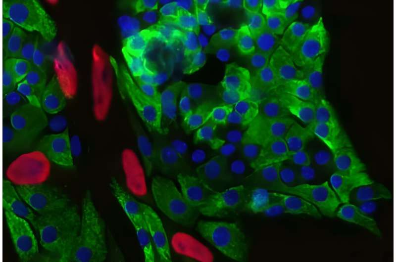 Boosting beta cells to treat type 2 diabetes