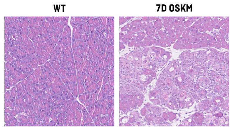 Study finds vitamin B12 is a key player in cellular reprogramming and tissue regeneration