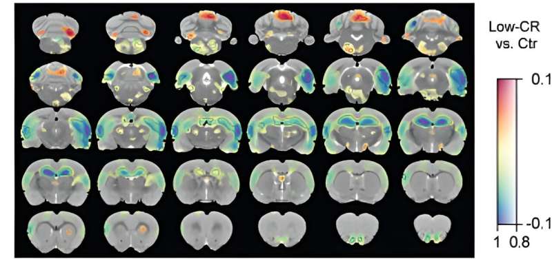 Why we don't all develop posttraumatic stress disorder?