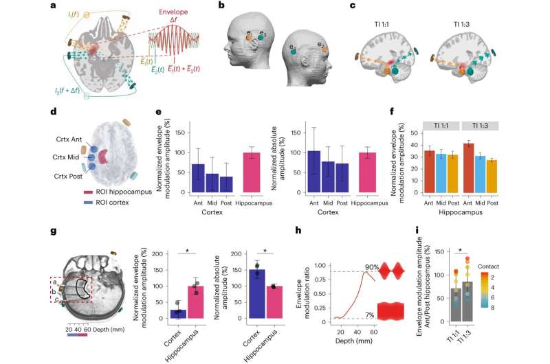 Surgery-free brain stimulation could provide new treatment for dementia