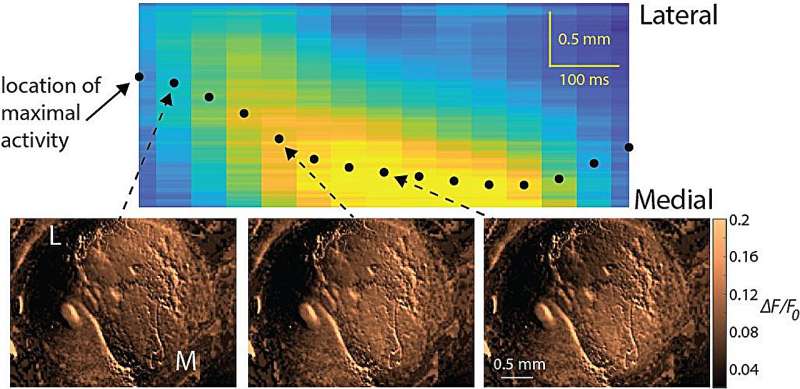 A wave theory for a neurochemical balance in the brain