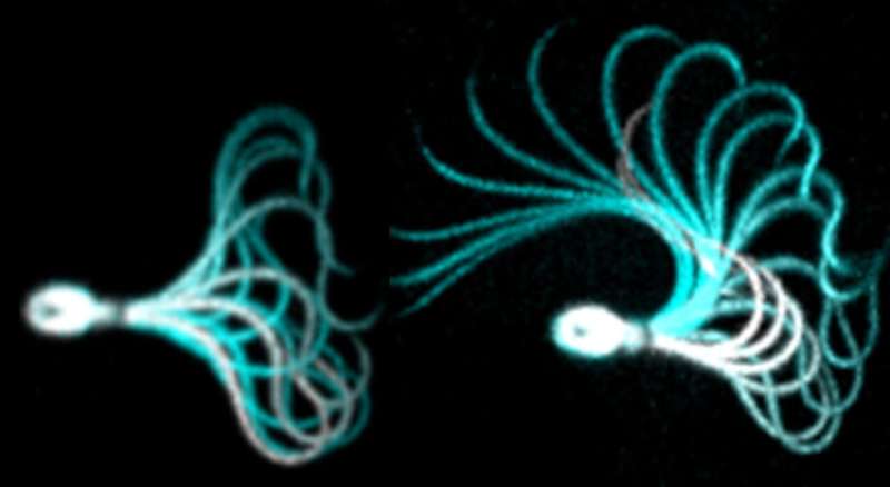 Defective ion channel in sperm flagellum renders men infertile and frustrates medically assisted reproduction