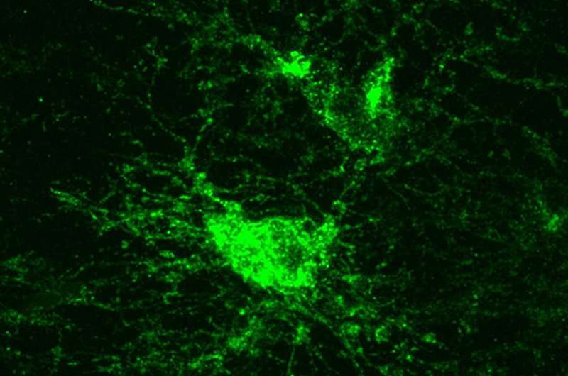 Surprising finding links sleep, brain insulation and neurodegeneration