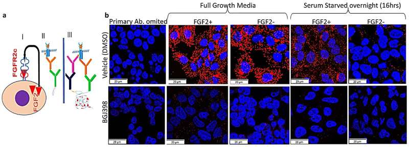 Organoids study discovers promising treatment for deadly uterine cancer