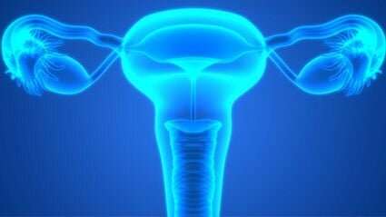 Early diagnosis of high-grade serous ovarian cancer feasible