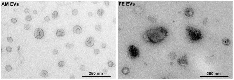 Researchers identify new mechanism of communication between maternal gut bacteria and the fetus