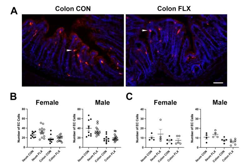 Antidepressants taken during pregnancy may affect children's digestive health