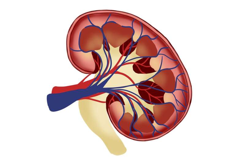 Abnormal lactate metabolism linked to kidney injury in diabetic patients 