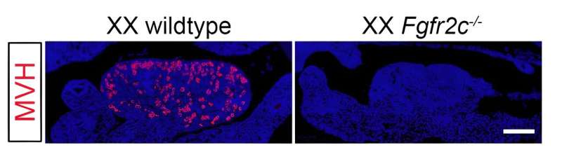 Gene link to female infertility