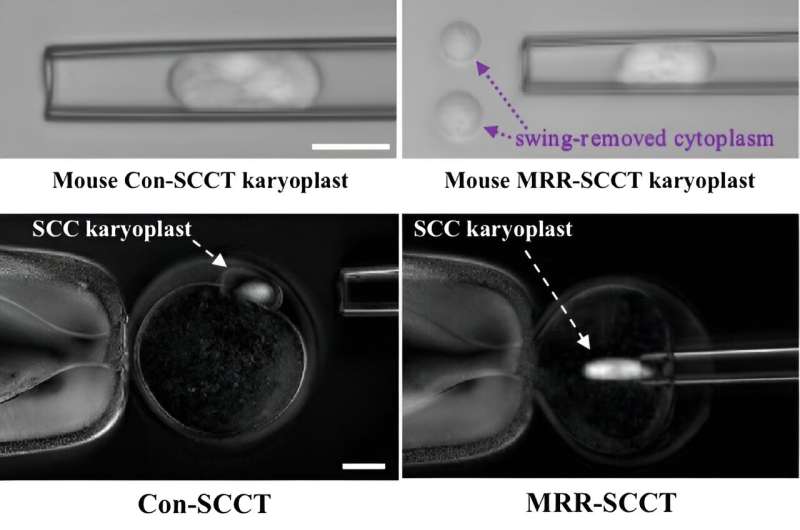 Novel procedure reduces the risk of mitochondrial disease transmission