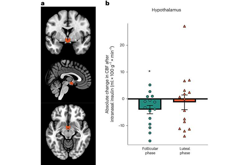 Brain sensitivity to insulin may be modulated by menstrual cycle