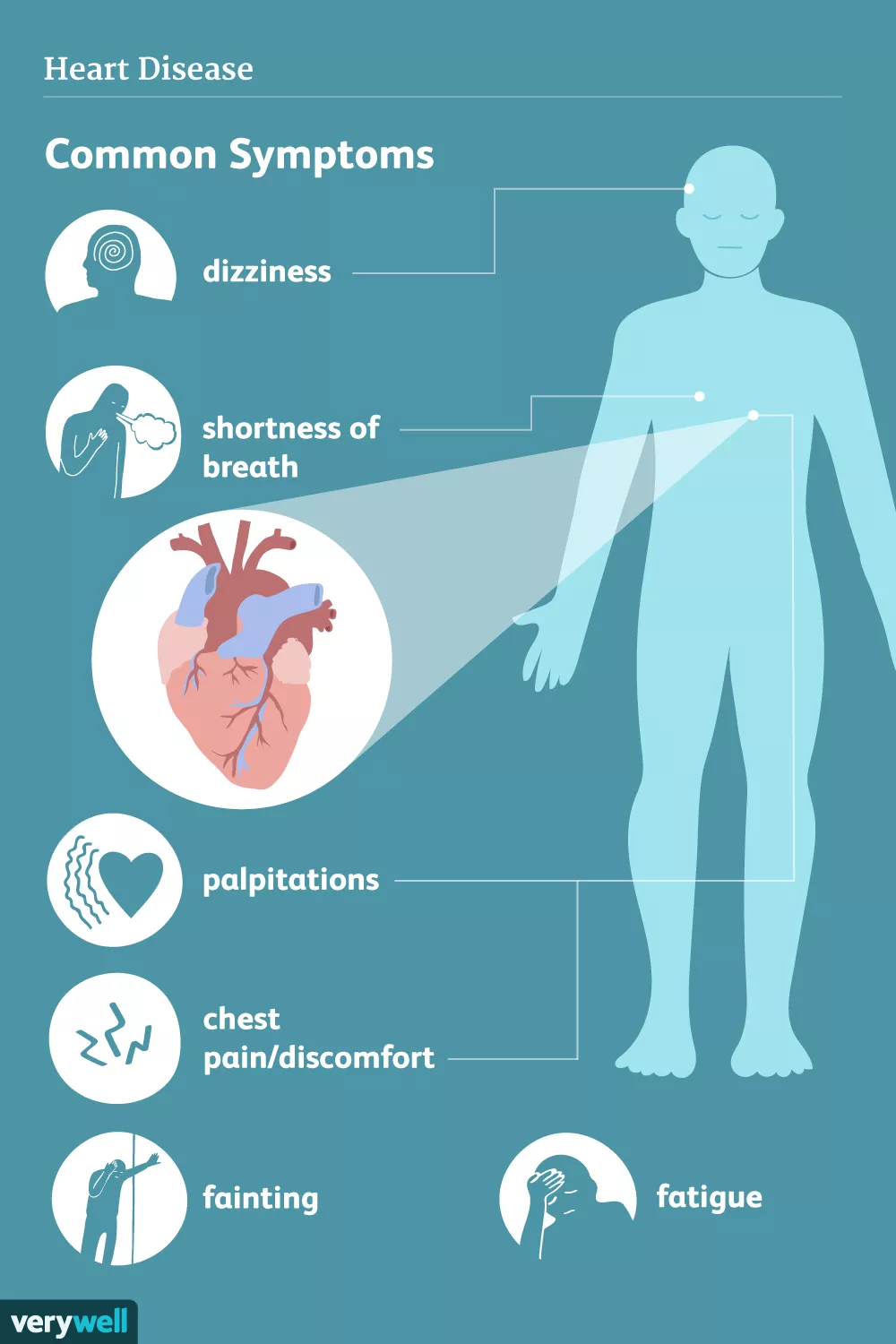 Symptoms of Heart Disease