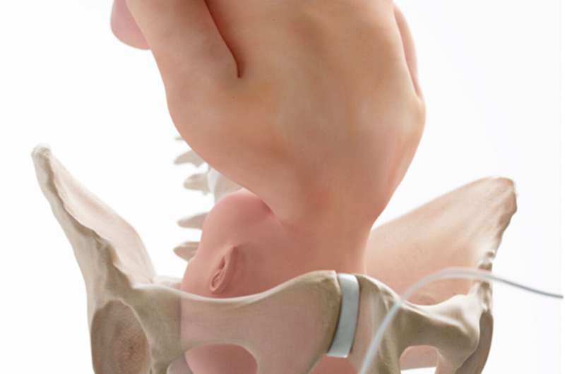 Cesarean birth injury rates have risen for moms and babies, but training and new device could change that