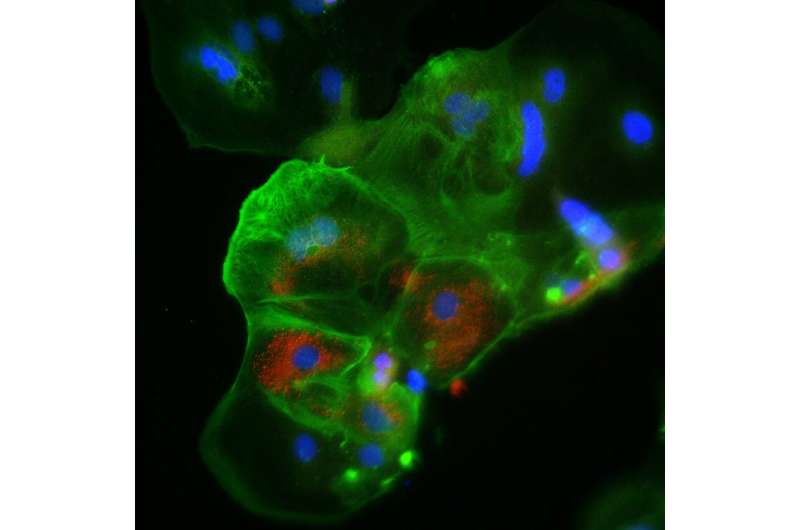 How COVID-19 crosses the placenta: Study uses lab-grown placental tissue to model infection