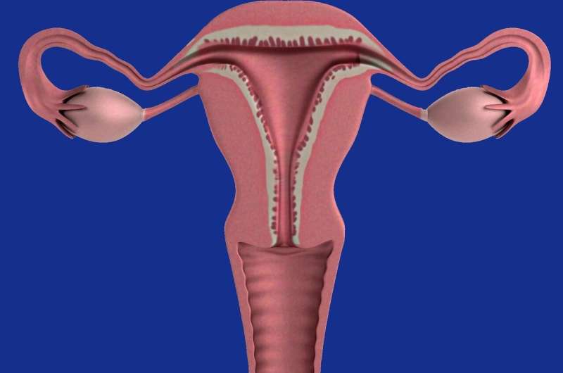 Scientists develop new model for understanding uterine fibroids