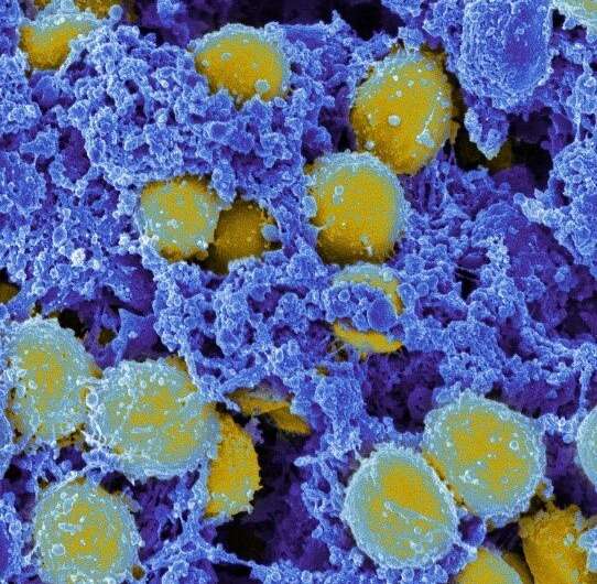 Staphylococcus aureus