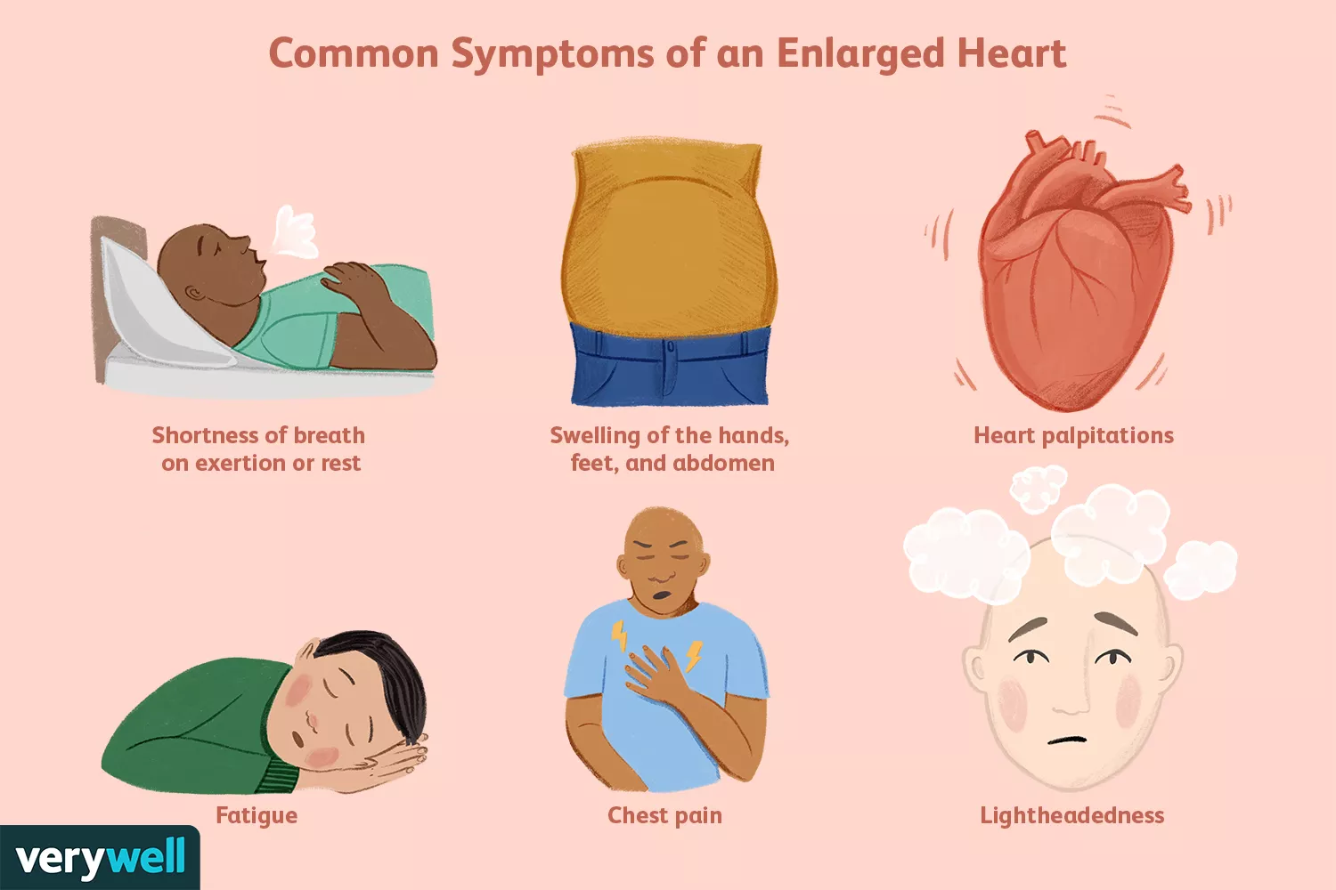 Is Having an Enlarged Heart Serious?