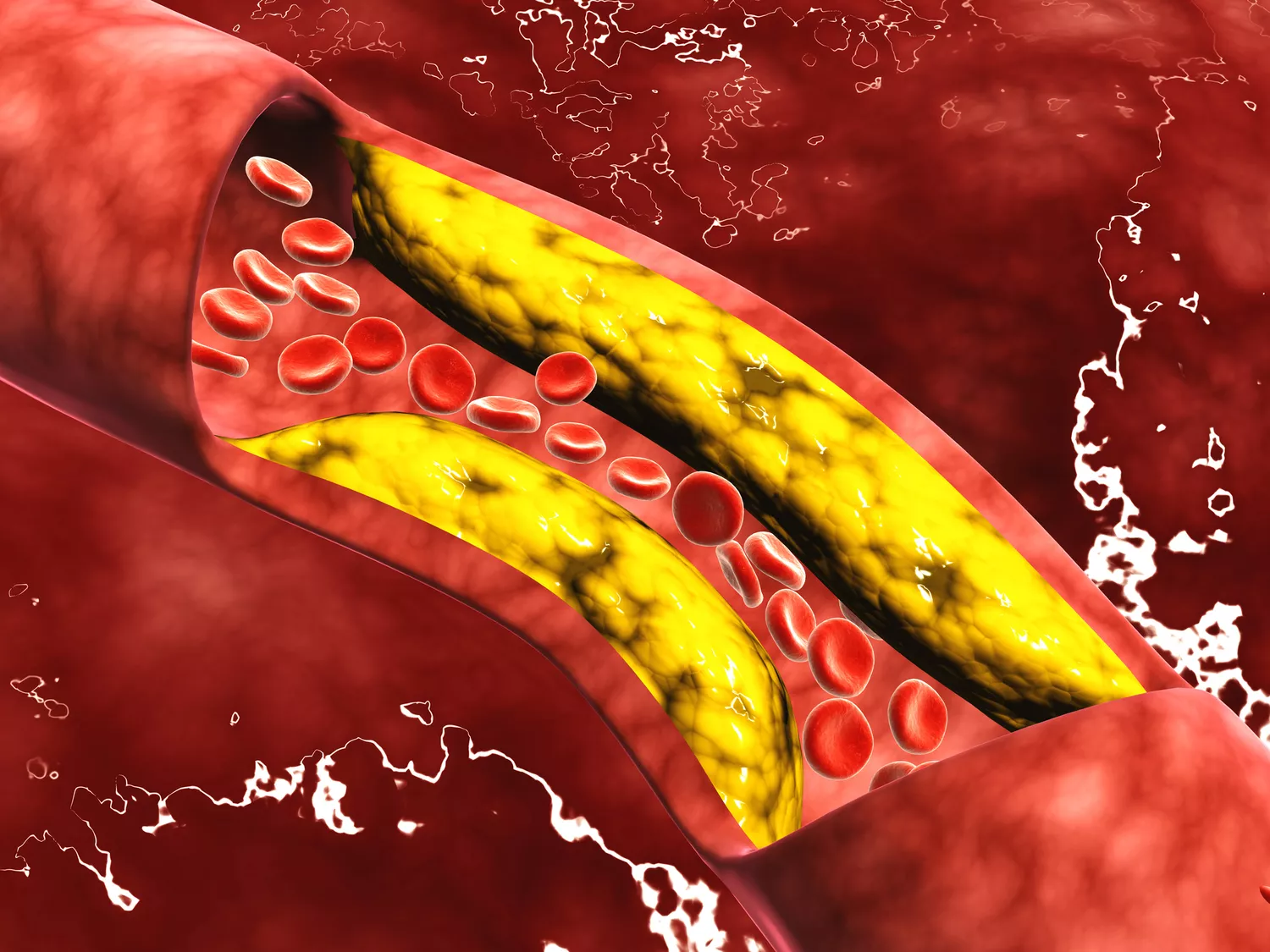 An Examination of the Cholesterol Hypothesis