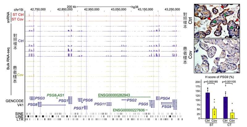 Joint study unveils how COVID-19 adversely impacts placenta during pregnancy