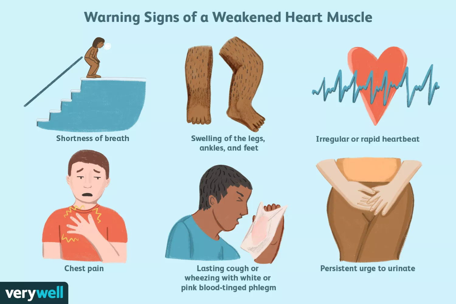 Weak Heart Symptoms and Treatments