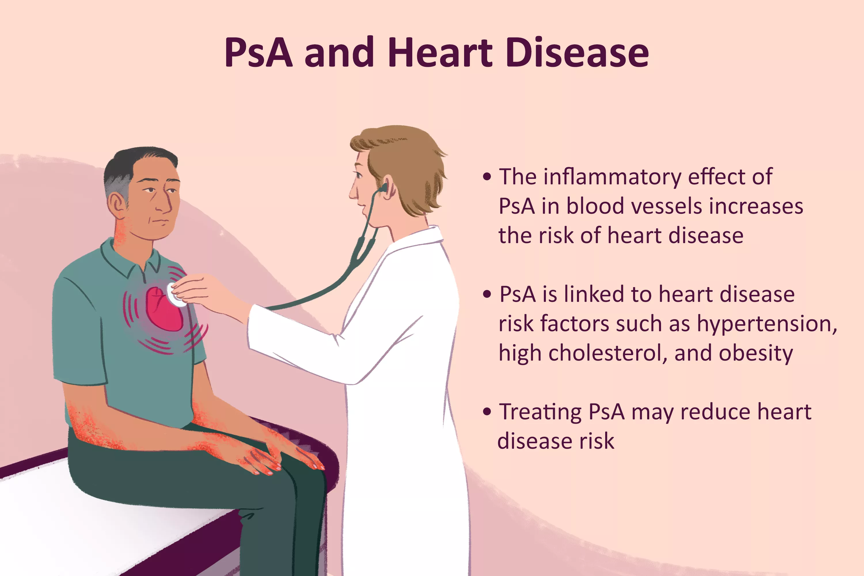 The Link Between Psoriatic Arthritis and Heart Disease