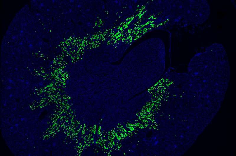 Singapore scientists find that supplementation with a special omega-3 lipid could treat acute kidney injury