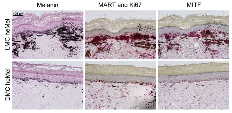 Penn Research Shows that DOPA Protects Against Melanoma