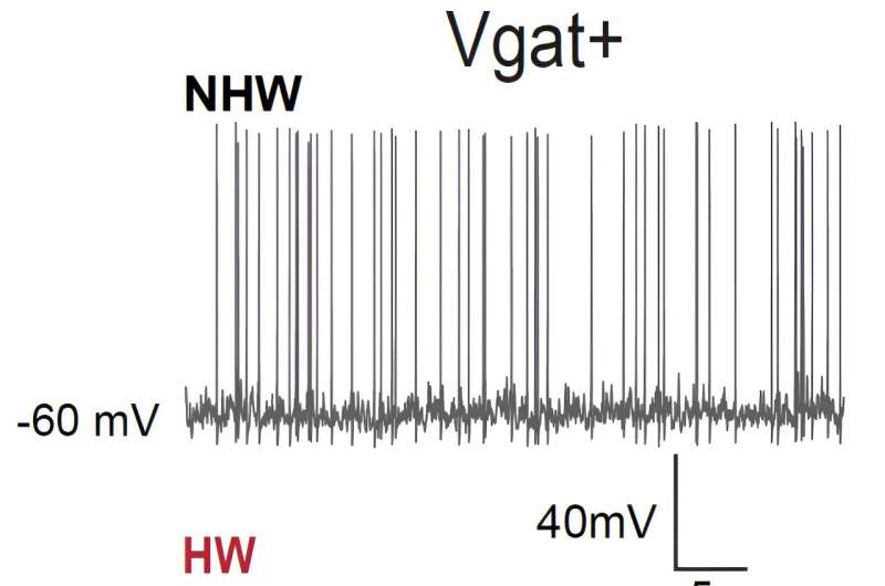 Study shows medial preoptic area mediates depressive-like behaviors associated with ovarian hormone fluctuations