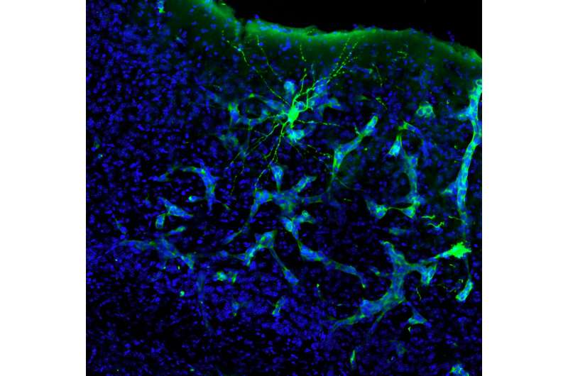 Pioneering study finds that brain tumours 'hack' the communication between neurons