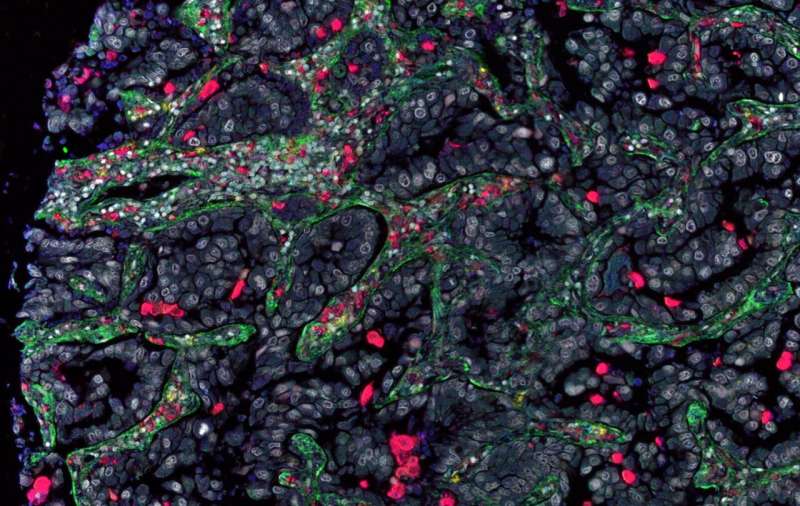 How communication in the tumor microenvironment influences tumor development