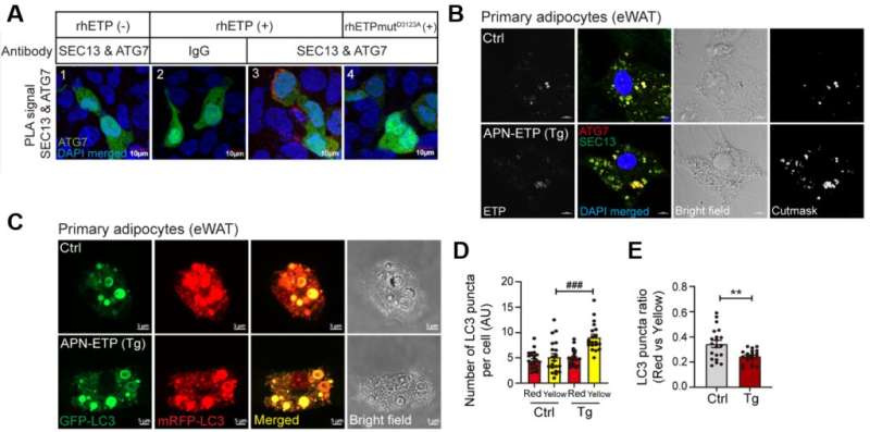 Unraveling the link between obesity, diabetes and endotrophin