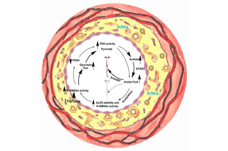 Acetate controls endothelial-to-mesenchymal transition: Potential therapeutic target for reducing atherosclerosis