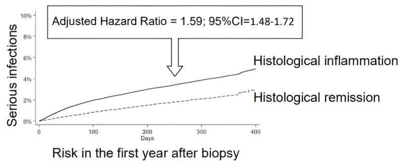 Risk of serious infection even in low-active IBD