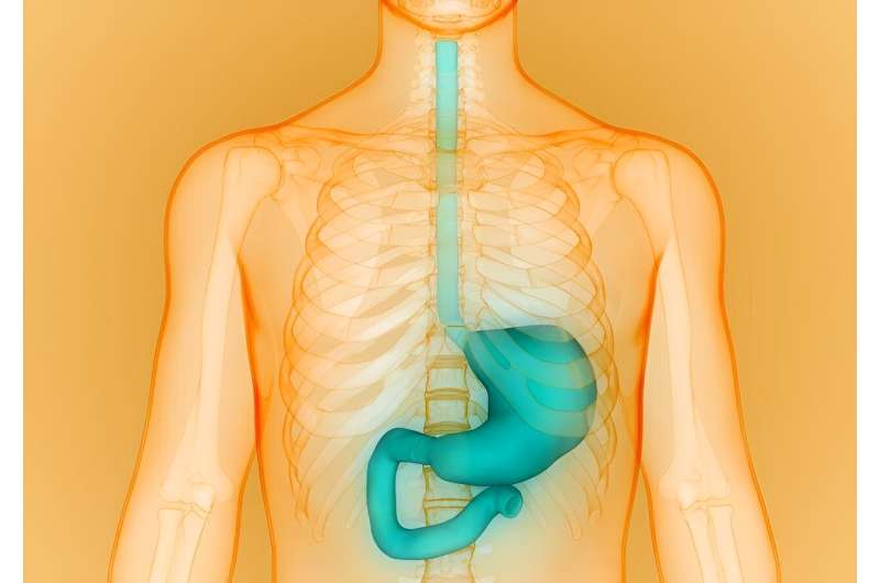 Antireflux mucosal ablation safe, effective for refractory reflux disease