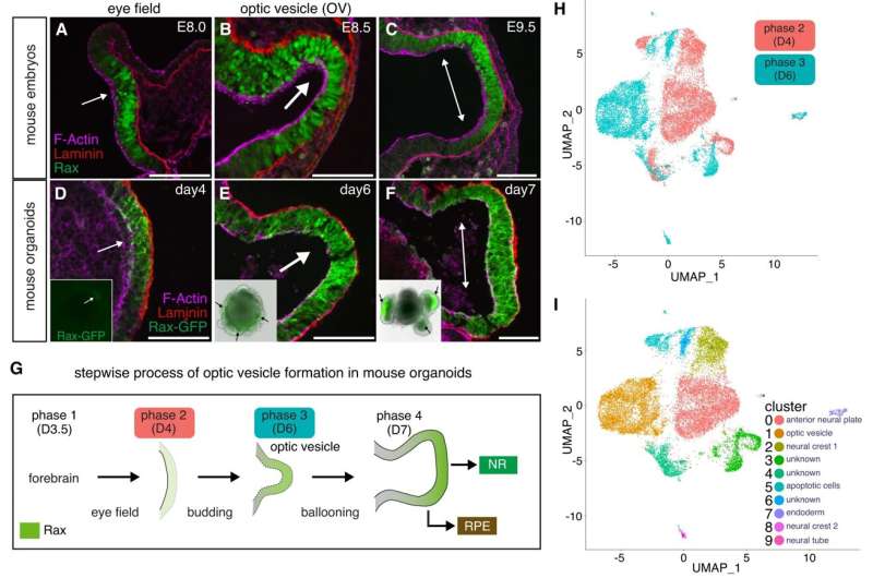 Understanding the metabolites underlying eye development