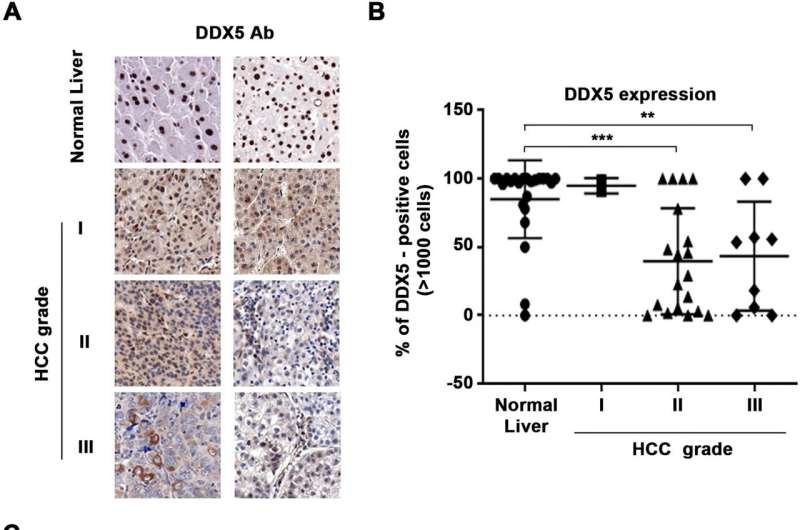 Discovery points to new approach to treating liver cancer