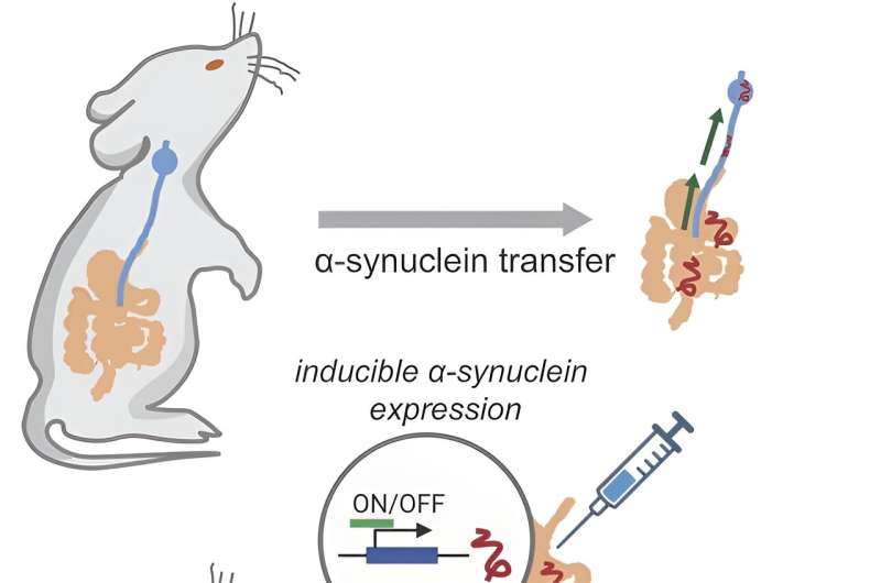 New evidence suggests link between gut health and Parkinson's disease