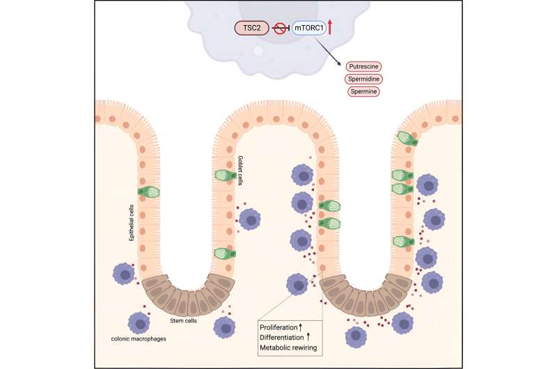 Immune cells identified as 'metabolic factories' in the gut